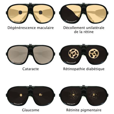 simulation de lunettes.